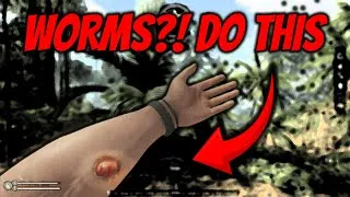 Thumbnail: How to REMOVE Worms in Green Hell (FAST & IN-DEPTH)