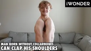 Thumbnail: I Was Born Without Collarbones