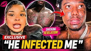 Thumbnail: Chrisean Rock Exposes How Blueface Passed HIV STD To Her