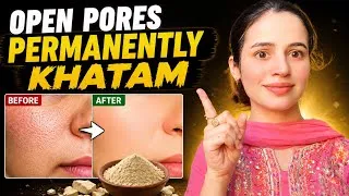 Thumbnail: How to Close Open Pores Permanently at Home | Chehre ke Surakh Band Karne ka Tarika