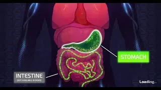 Thumbnail: Pathogenic - I am the reason your bowels hurt