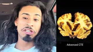 Thumbnail: Former Basketball Prodigy Has Lost His Mind