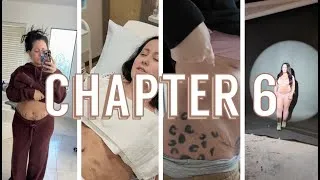 Thumbnail: Tummy Tuck Journey - Final Chapter Q & A Continued