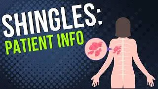 Thumbnail: Shingles Patient Information