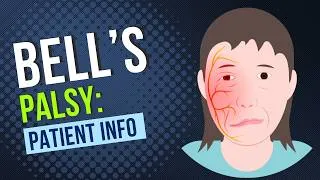 Thumbnail: Bell's Palsy patient information