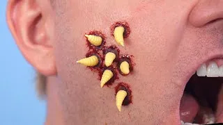 Thumbnail: MAGGOTS CRAWL OUT FACE!