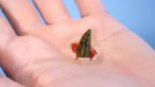 Thumbnail: WORM EATS WAY OUT OF SKIN!