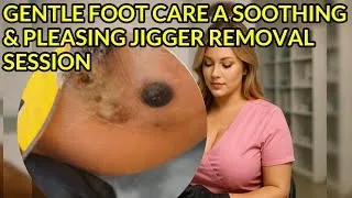Thumbnail: Gentle Foot Care | A Soothing & Pleasing Jigger Removal Session