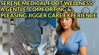 Thumbnail: Serene Medical Foot Wellness | A Gentle, Comforting & Pleasing Jigger Care Experience