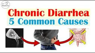 Thumbnail: 5 Common Causes of Chronic Diarrhea (Many People Don't Know About #4)