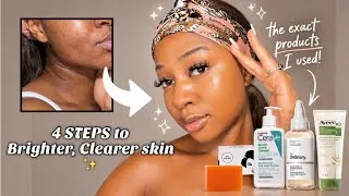 Thumbnail: I Fixed My Dark Spots & discolouration in 4 easy Steps ( picture results included) ✨