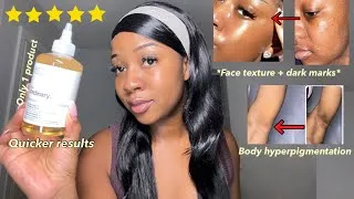 Thumbnail: HOW TO USE GLYCOLIC ACID TONER FOR MORE EFFECTIVE RESULTS | Face + Body hyperpigmentation