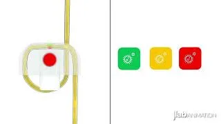 Thumbnail: Urine Testing - 3D Medical Animation