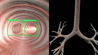 Thumbnail: Short 3D Animation of the Gastroscopy