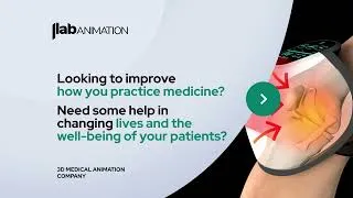 Thumbnail: Medical Device Animation Overview