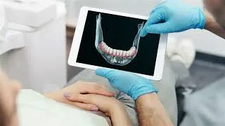 Thumbnail: Dental Animation Overview