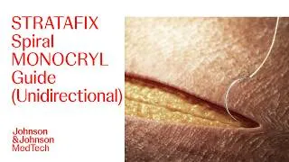 Thumbnail: STRATAFIX Spiral MONOCRYL Antibacterial Barbed Suture (Unidirectional) Technique | J&J MedTech