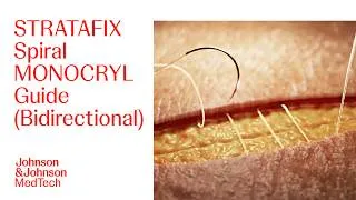 Thumbnail: STRATAFIX Spiral MONOCRYL Antibacterial Barbed Suture (Bidirectional) Technique | J&J MedTech