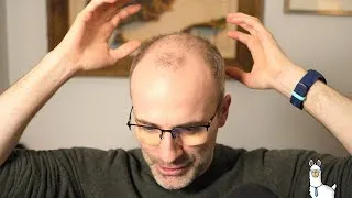 Thumbnail: January 2026 Q&A