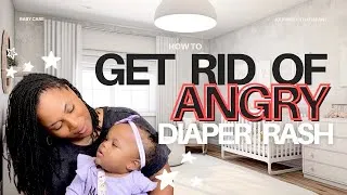 Thumbnail: FINALLY say Good Bye 👋🏾 to that Angry Aggressive Diaper Rash! 2025