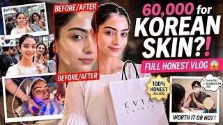 Thumbnail: 🇰🇷 I Tried a ₩1,000,000 Korean Beauty Treatment 🇰🇷 | Korean Glass Skin Secret?