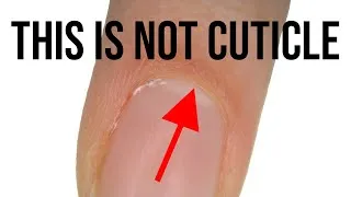 Thumbnail: What Is Cuticle?