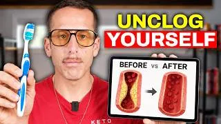 Thumbnail: How I'd Reverse 20 Years of Arterial Plaque (3 Simple Changes)