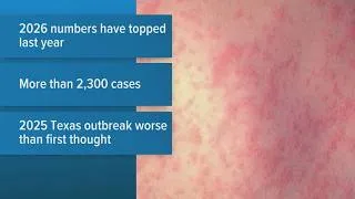 Thumbnail: New data shows U.S. measles outbreak may be worse than official numbers suggest