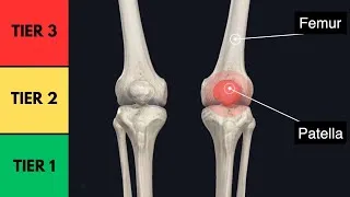 Thumbnail: Patellofemoral Joint Exercises Ranked (LEAST to MOST Knee Load)