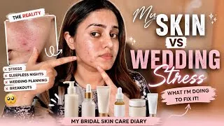 Thumbnail: Wedding Stress Ruined My Skin 😭 My Bridal Skincare Routine for Stress Breakouts | Kp Styles