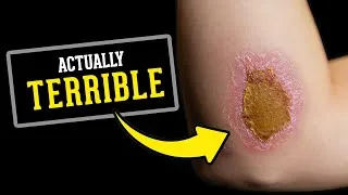 Thumbnail: Everything We Learned About Healing is WRONG, Here’s Why