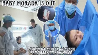 Thumbnail: Kamukha ni Alex Gonzaga ang baby nila ni Mikee Morada 💙 finally baby morada is out dami napagdaanan