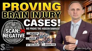 Thumbnail: How To Win A Brain Injury Case? #personalinjurylawyer #braininjury