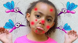 Thumbnail: I'm So Itchy Nursery Rhymes Song | More Nursery Rhymes and Children's Songs