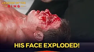 Thumbnail: AJ Styles' BRUTAL Match That Made Him a LEGEND