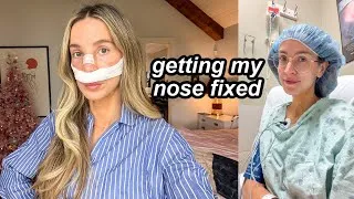 Thumbnail: got my nose fixed then life fell apart | VLOG