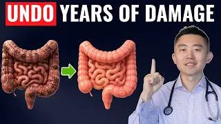 Thumbnail: Gut Detox: The Fastest Way To Repair Your Gut Naturally (Backed by Science)