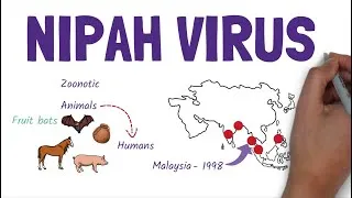 Thumbnail: What Is Nipah Virus? Should we be concerned?