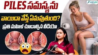Thumbnail: పైల్స్‌ను ఏళ్ల తరబడి వాయిదా వేస్తే ఏమవుతుందిమహిళలు పైల్స్ సమస్యను ఎందుకు దాచేస్తున్నారు? Dr Sunitha