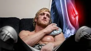 Thumbnail: I Tore My Tricep (6 Month Recovery)