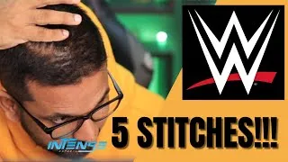 Thumbnail: 😥😰 തലയിലെ 5 STITCHES 😰 Lord Lincoln തല പൊട്ടിയ childhood WWE story പറഞ്ഞപ്പോൾ 🥲🥲
