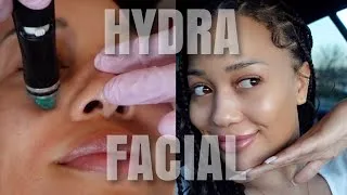 Thumbnail: I Tried a Deluxe HYDRAFACIAL! Everything You Need to Know Revealed | Glowing Skin!