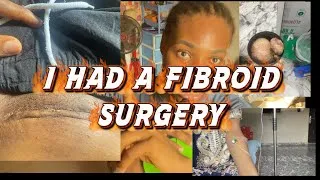 Thumbnail: I had FIBROID surgery