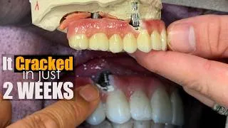 Thumbnail: Why Do Your Zirconia Implants Crack? Here Is My Solution