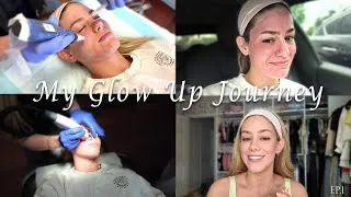 Thumbnail: GLOW UP SERIES | Road To The Wedding: I get Microneedling done! | Ep. 1