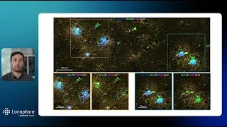 Thumbnail: High-resolution spatial mapping of Alzheimer’s Disease with COMET™