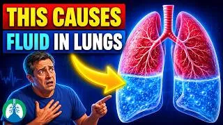 Thumbnail: Fluid in the Lungs | Causes, Prevention, and How to Remove