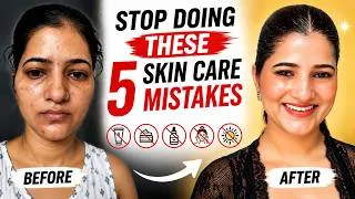 Thumbnail: 5 Skincare Mistakes Ruining Your Skin Transformation (Stop Now!)