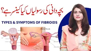 Thumbnail: What is Fibroids in Uterus ? Symptoms and Types of Fibroids - Dr Maryam Raana Gynaecologist