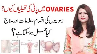 Thumbnail: Anda Dani Ki Rasoli Ka Ilaj | Ovarian Cyst Signs And Symptoms - Dr Maryam Raana Gynaecologist